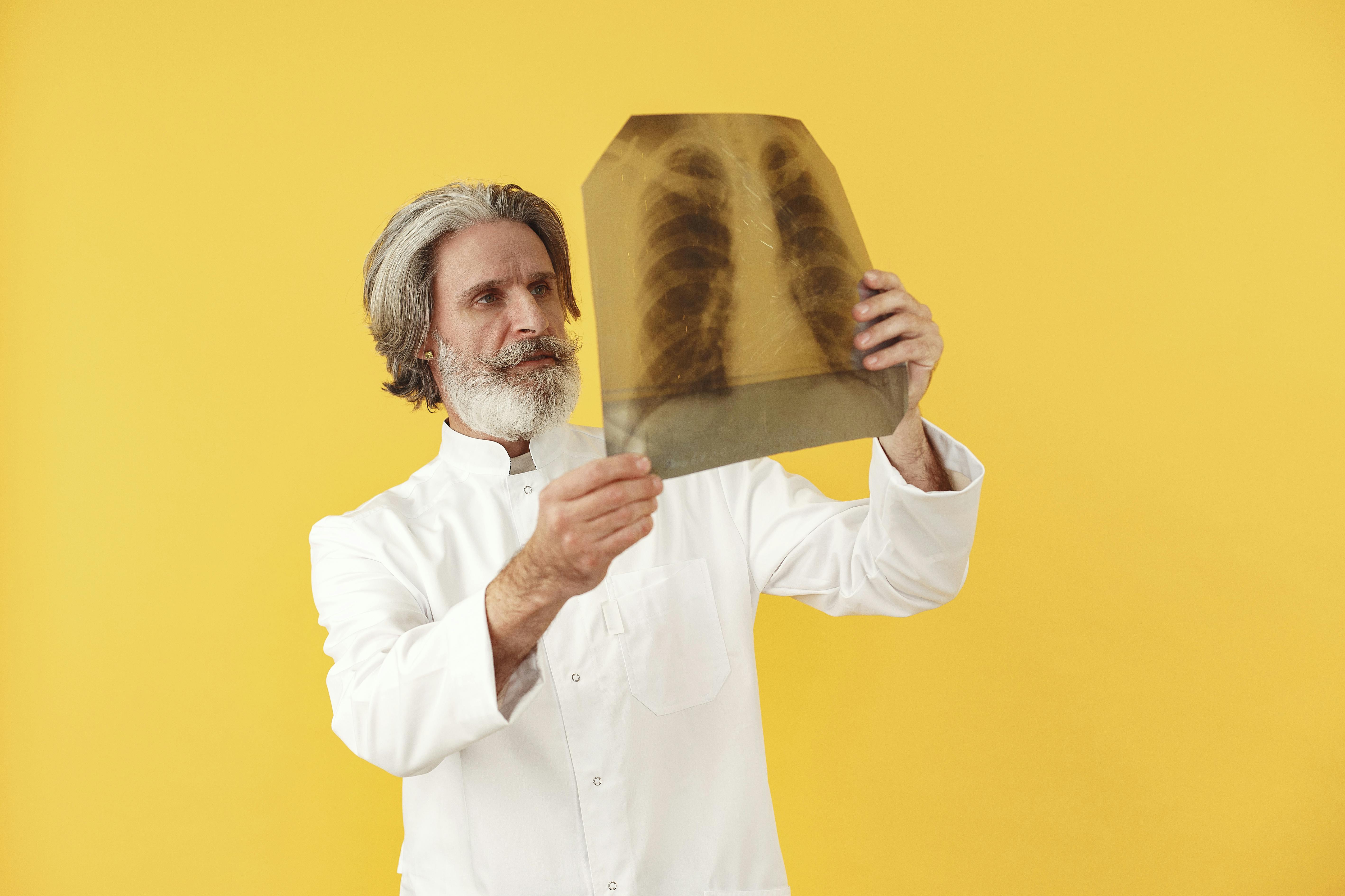 A man with salt-and-pepper hair and a beard holds a picture of an x-ray.